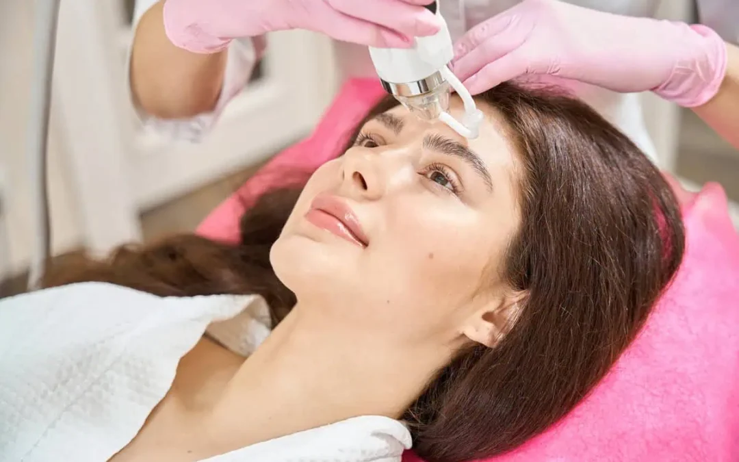 RF Microneedling: The Key to Unlocking Flawless Skin