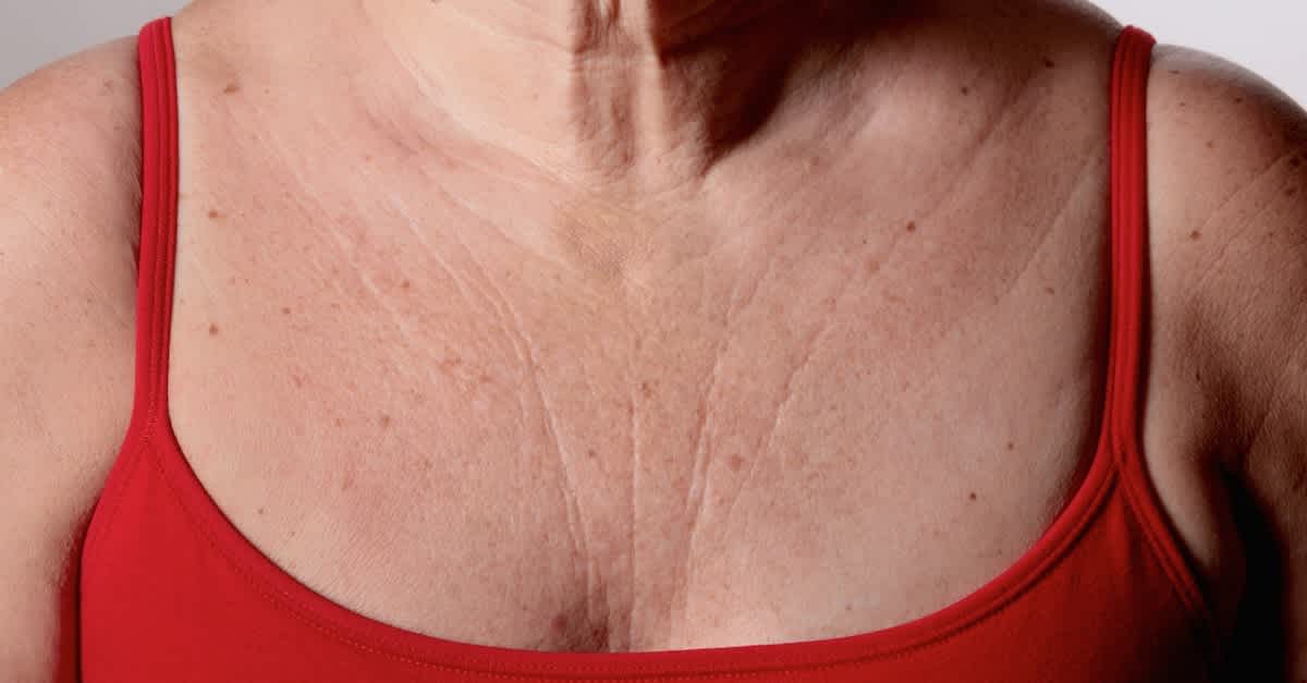 Decolletage