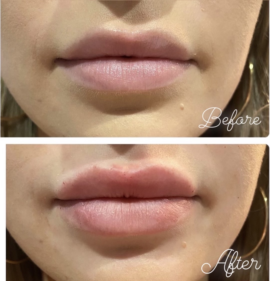 B Lively Lips 1