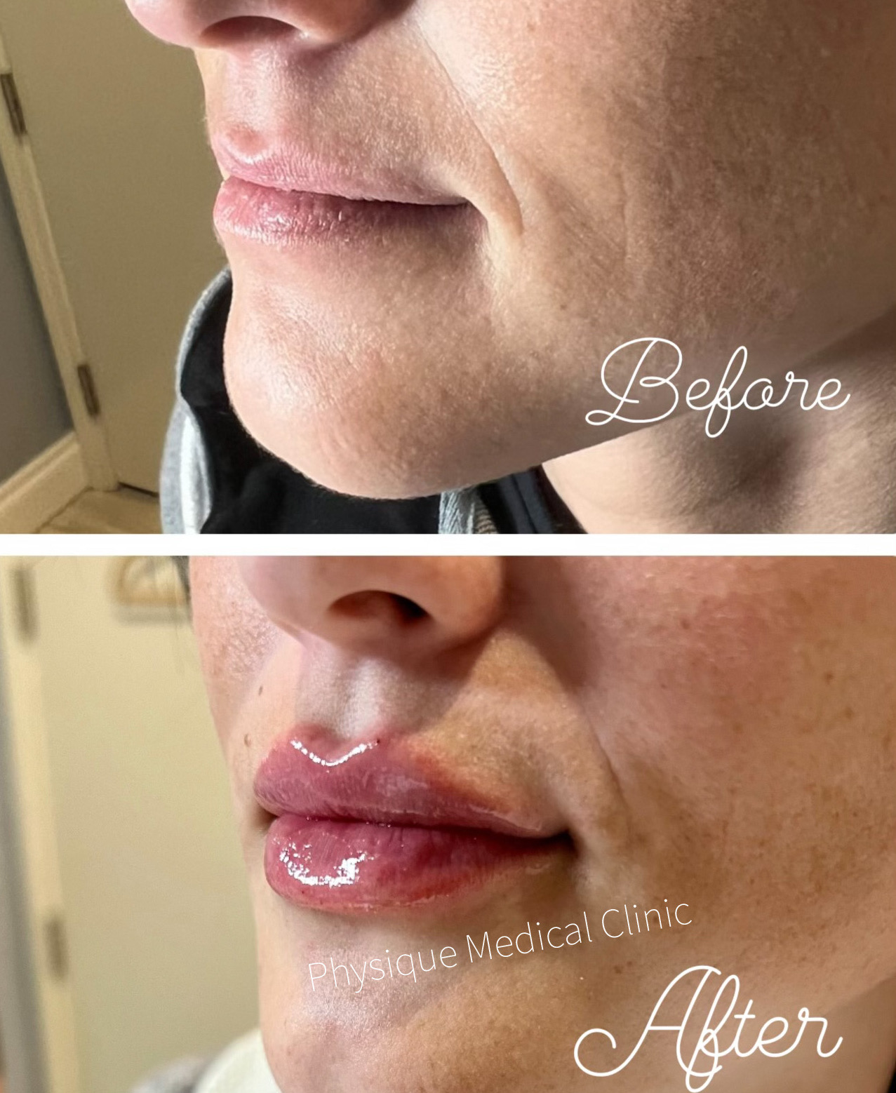 Physique Lips Feb 7