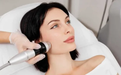 RF Microneedling vs. Traditional Microneedling: Which One is Better?