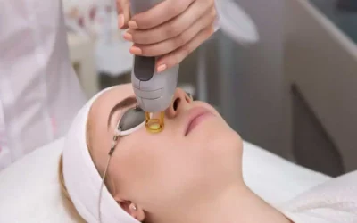 Why Laser Resurfacing is a Game-Changer for Acne Scars and Fine Lines